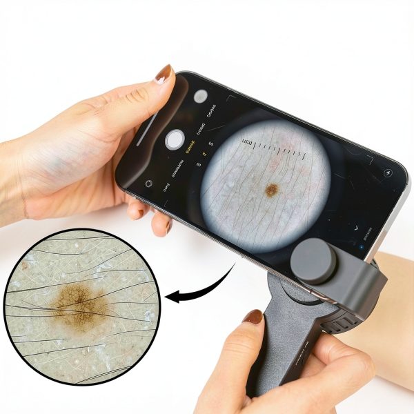 IBOOLO DE-3100 PRO Dermatoscope Handheld Portable with 10x-4